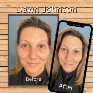 2 images side by side demonstrating the BEFORE - AFTER possibilities using MarysBlendedBeauty.online - custom blended foundation actual client - Dawn Johnson of Ideal Feet