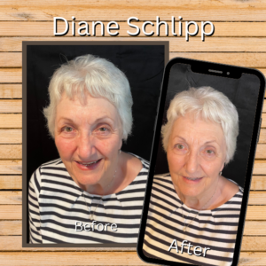 See the difference between before & after images - Mary's Blended Beauty custom blended client - Diane Schlipp