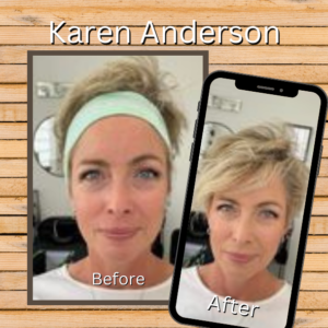 2 images side by side demonstrating the BEFORE - AFTER possibilities using MarysBlendedBeauty.online - custom blended foundation actual client Karen Anderson