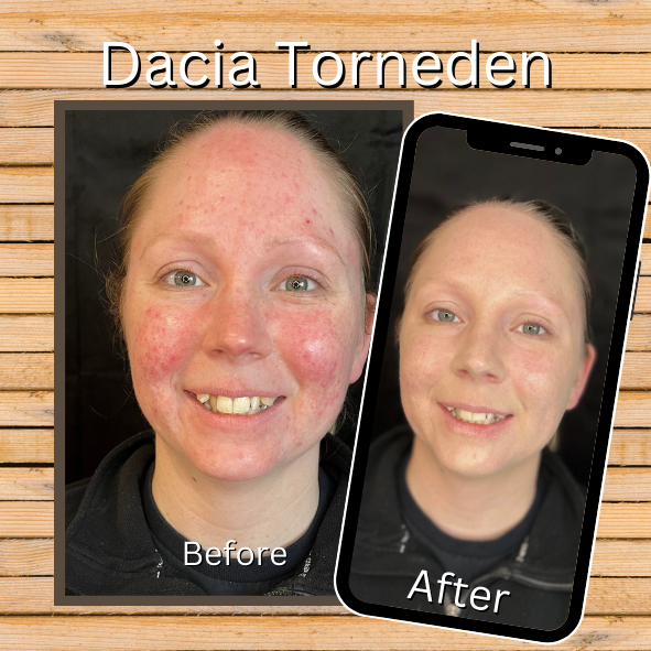 Before and after images of custom blended client Dacia Torneden MarysBlendedBeauty.online